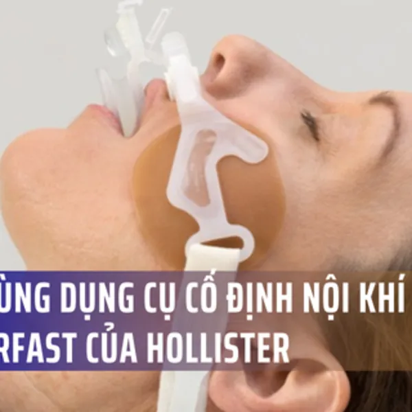 Hướng dẫn cách dùng Cố định nội khí quản AnchorFast của Hollister