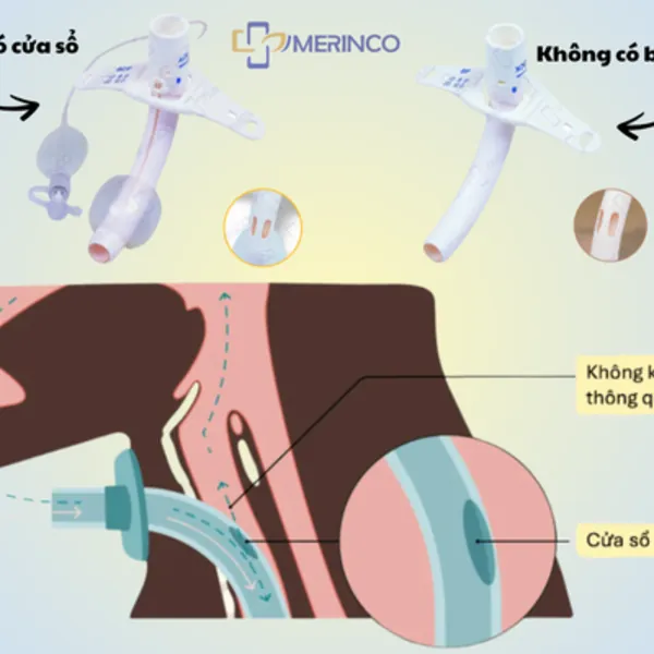 So sánh canyun mở khí quản có cửa sổ và không có cửa sổ