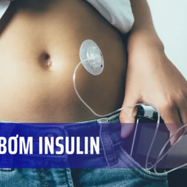 Máy bơm Insulin