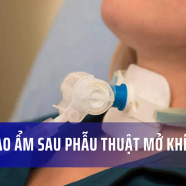 Hướng dẫn Tạo ẩm sau Phẫu thuật mở khí quản và Thở máy