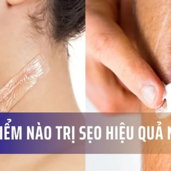 Thời điểm nào trị sẹo hiệu quả nhất?