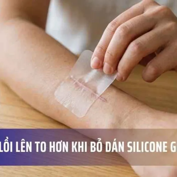 Lý Do Sẹo Lồi Lên To Hơn Khi Bỏ Dán Silicone Giữa Chừng
