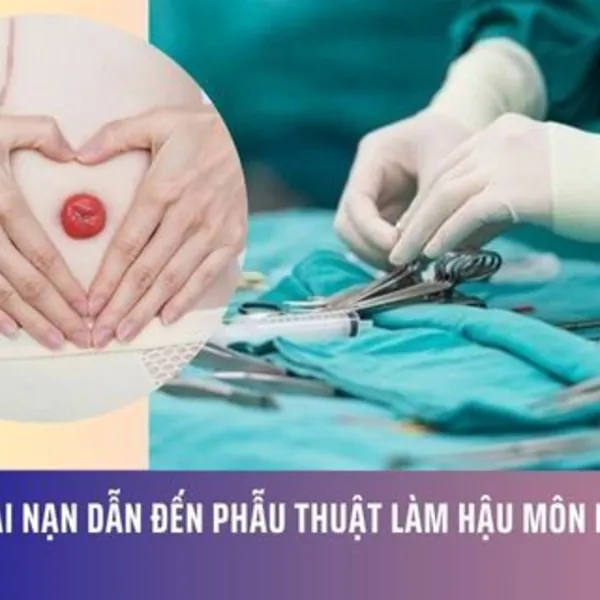 Những Tai Nạn Dẫn Đến Phẫu Thuật Làm Hậu Môn Nhân Tạo