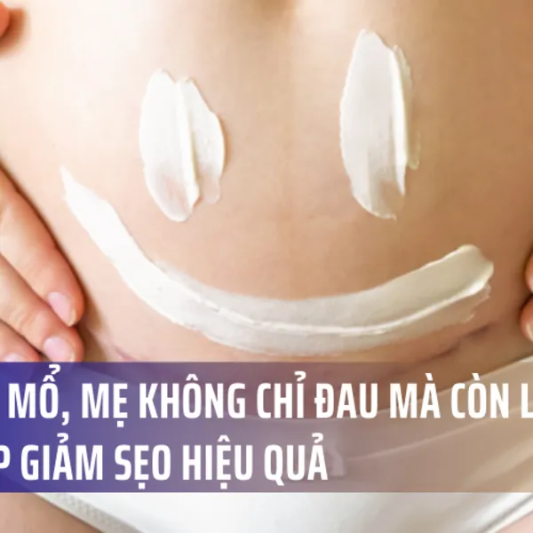 Sau Sinh Mổ, Mẹ Không Chỉ Đau Mà Còn Lo…Sẹo: Giải Pháp Giảm Sẹo Hiệu Quả