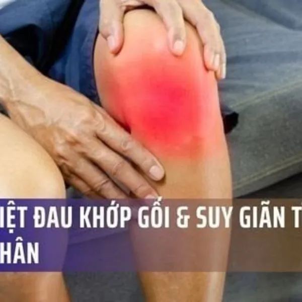 Phân Biệt Đau Khớp Gối & Suy Giãn Tĩnh Mạch Chân