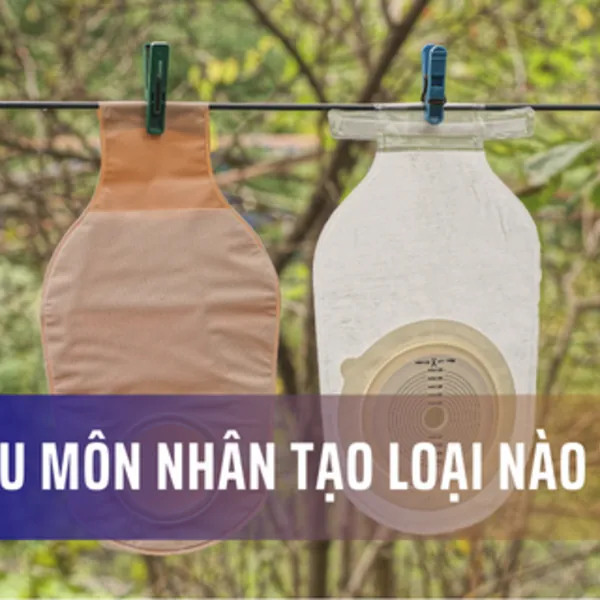 Túi hậu môn nhân tạo loại nào tốt?