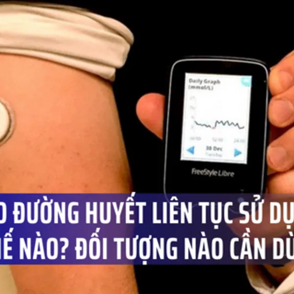 Máy đo đường huyết liên tục sử dụng như thế nào? Những ai cần dùng?