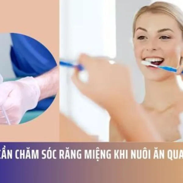 Tại Sao Cần Chăm Sóc Răng Miệng Khi Nuôi Ăn Qua Ống Nuôi Ăn