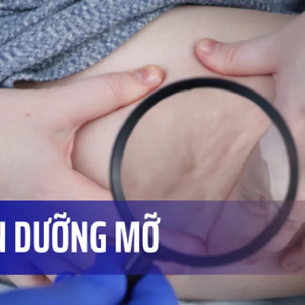 Loạn dưỡng mỡ