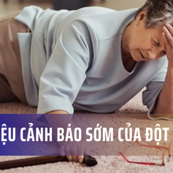 Dấu hiệu Cảnh báo Sớm của Đột quỵ là gì?