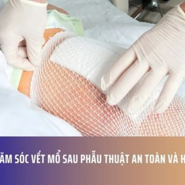 Cách Chăm Sóc Vết Mổ Sau Phẫu Thuật An Toàn Và Hiệu Quả