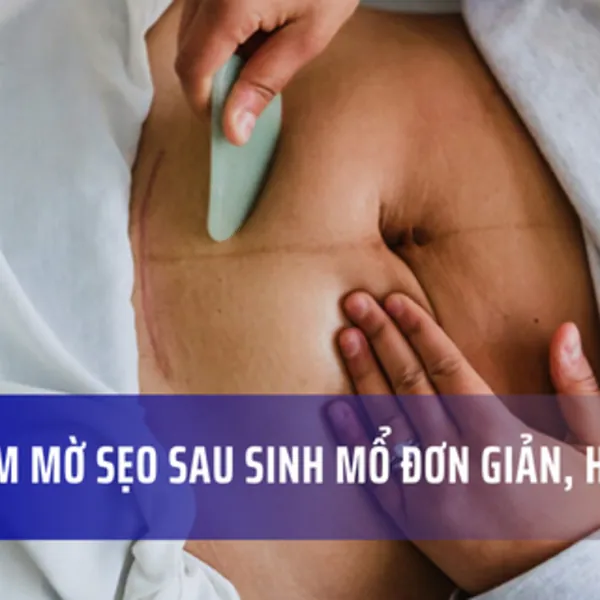 Cách làm mờ sẹo sau sinh mổ
