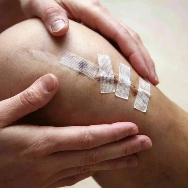 Tổng quan về chăm sóc vết thương hậu phẫu thuật