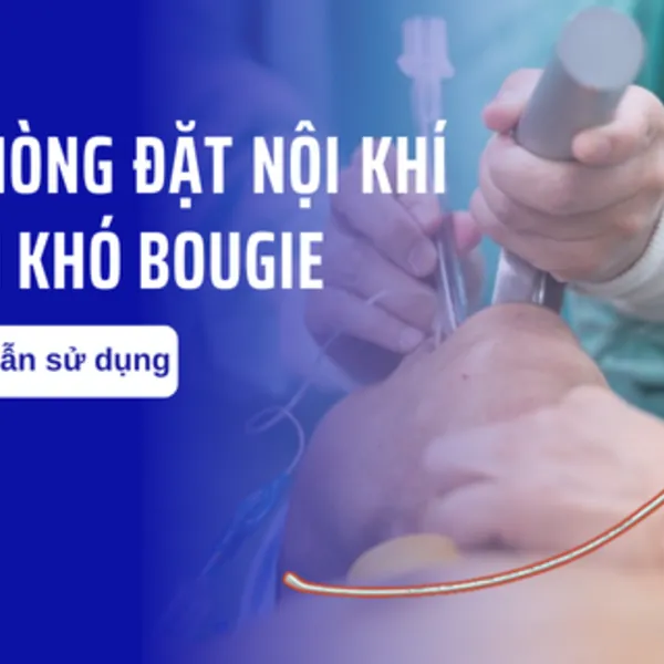 Hướng dẫn sử dụng cây nòng đặt nội khí quản khó Bougie