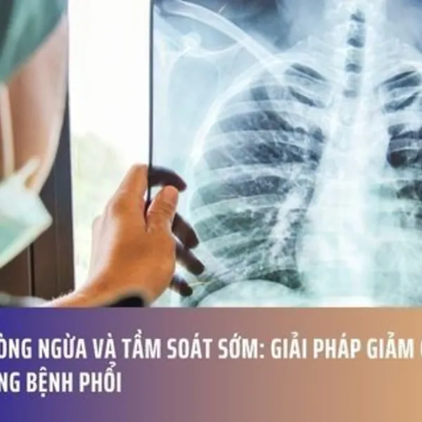 Phòng Ngừa Và Tầm Soát Sớm: Giải Pháp Giảm Gánh Nặng Bệnh Phổi