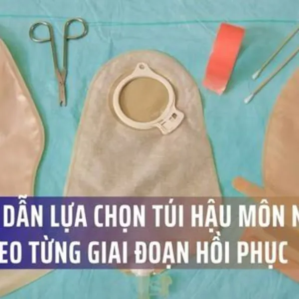 Hướng dẫn lựa chọn túi hậu môn nhân tạo theo từng giai đoạn hồi phục – Chia sẻ từ bác sĩ chuyên khoa