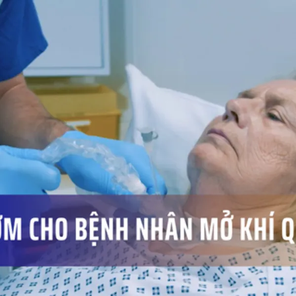 Hút đờm nhớt cho bệnh nhân mở khí quản