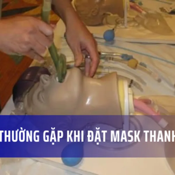 Các lỗi thường gặp khi đặt mask thanh quản: Mẹo và Cách khắc phục