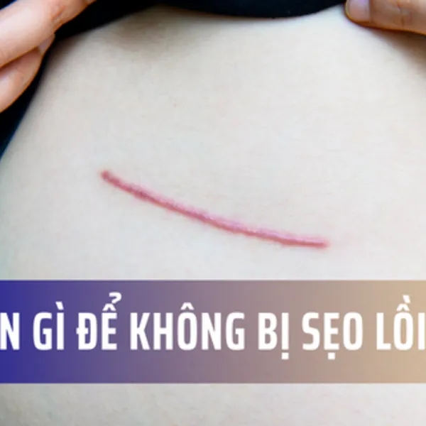 Nên ăn gì để không bị sẹo lồi?