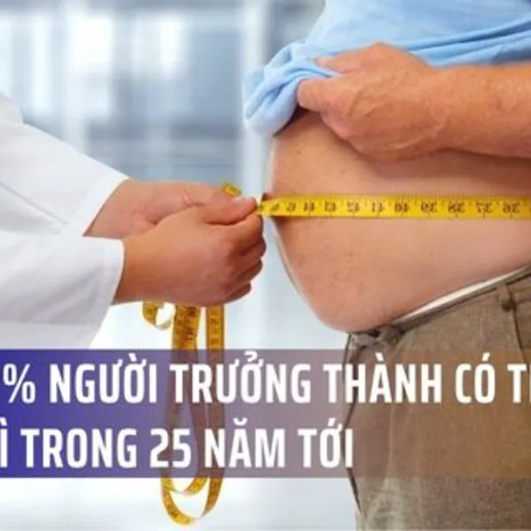Hơn 50% người trưởng thành có thể béo phì trong 25 năm tới