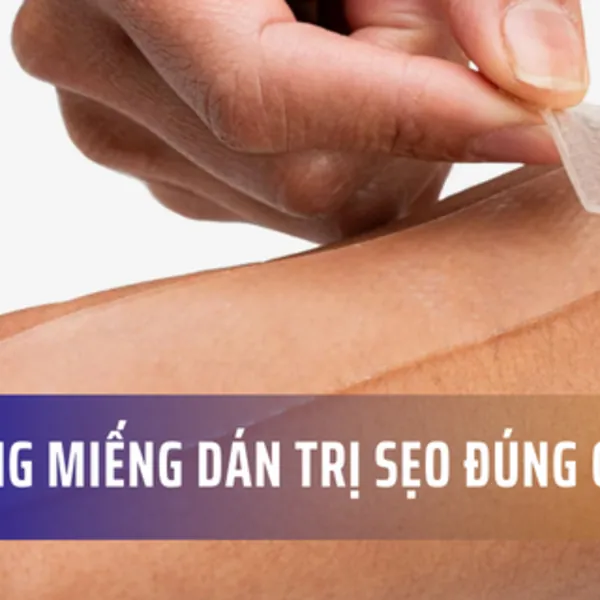 Hướng dẫn sử dụng miếng dán ép sẹo đúng cách