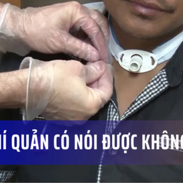 Mở khí quản có nói được không?