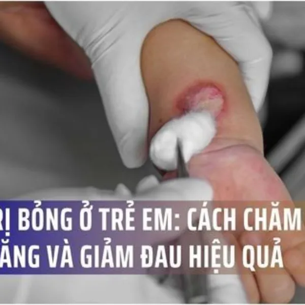 Điều Trị Bỏng Ở Trẻ Em: Cách Chăm Sóc, Thay Băng Và Giảm Đau Hiệu Quả
