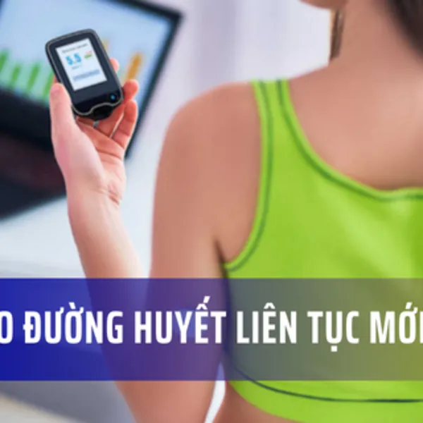 Cập nhật công nghệ trong điều trị bệnh tiểu đường: Máy đo đường huyết liên tục mới nhất