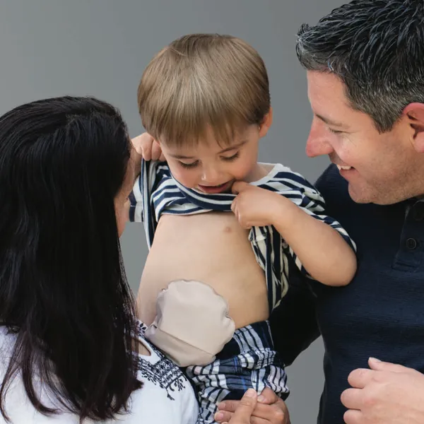 Chăm sóc hậu môn nhân tạo của con bạn (Colostomy)