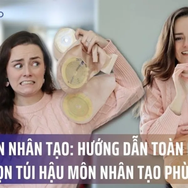 Hậu Môn Nhân Tạo: Hướng Dẫn Toàn Diện & Cách Chọn Túi Hậu Môn Nhân Tạo Phù Hợp