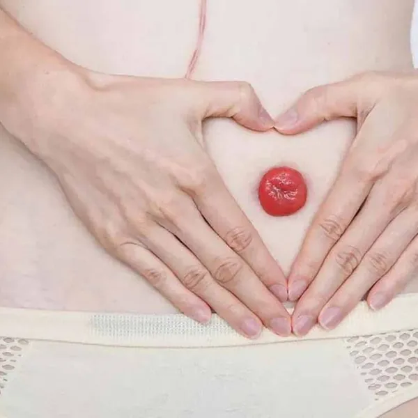 Nên làm gì khi chăm sóc người có hậu môn nhân tạo