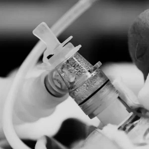 Cách Sử Dụng Và Chăm Sóc Ống Mở Khí Quản