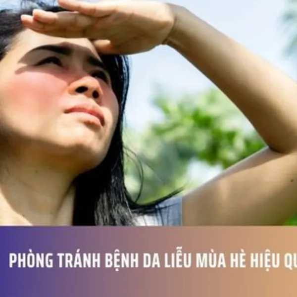 Phòng Tránh Bệnh Da Liễu Mùa Hè Hiệu Quả
