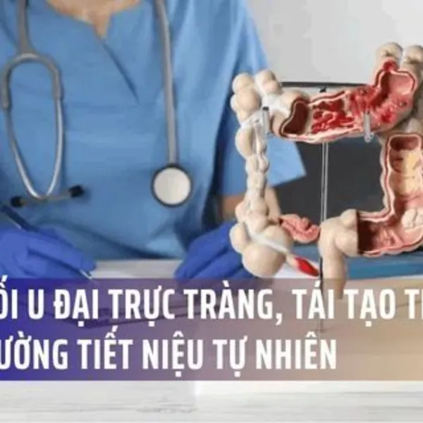 Phẫu Thuật Đột Phá: Cắt Khối U Đại Trực Tràng, Tái Tạo Thành Công Đường Tiết Niệu Tự Nhiên