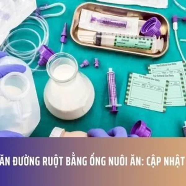 Nuôi Ăn Đường Ruột Bằng Ống Nuôi Ăn: Cập Nhật 2025