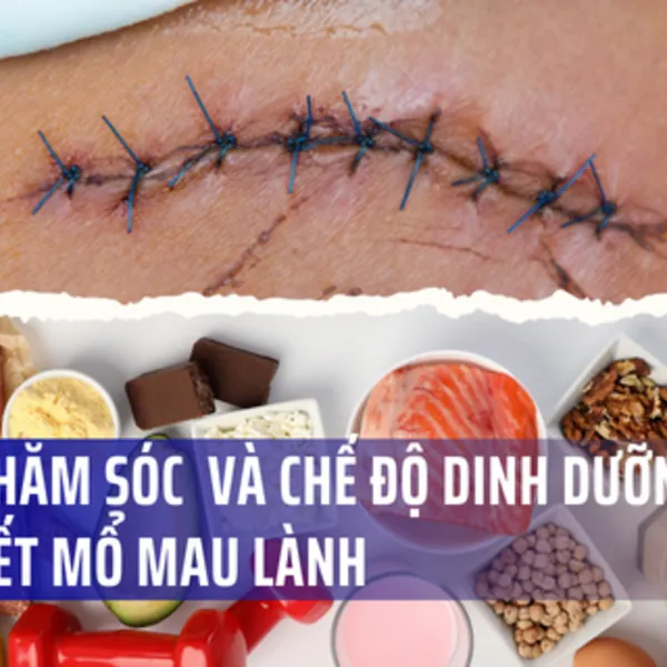 Cách chăm sóc và chế độ dinh dưỡng cho vết mổ sau phẫu thuật