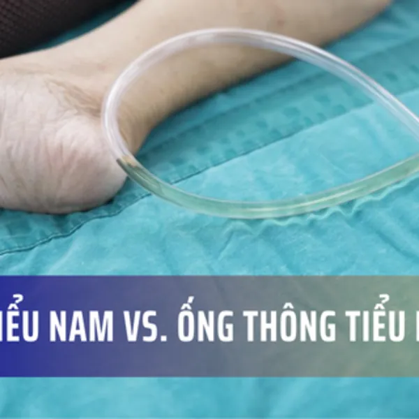 Phân biệt bộ chụp tiểu nam và ống thông tiểu foley
