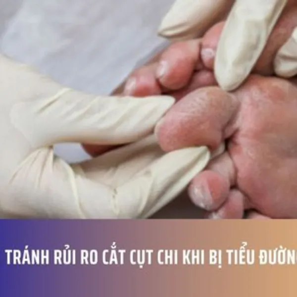 Tránh rủi ro cắt cụt chi khi bị tiểu đường