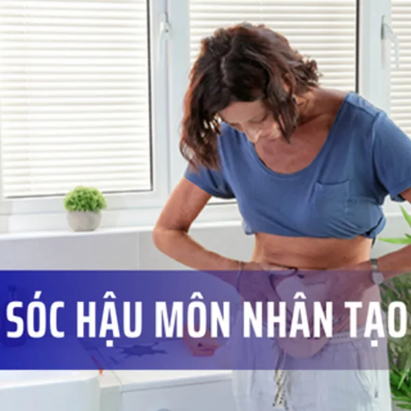 Chăm sóc hậu môn nhân tạo