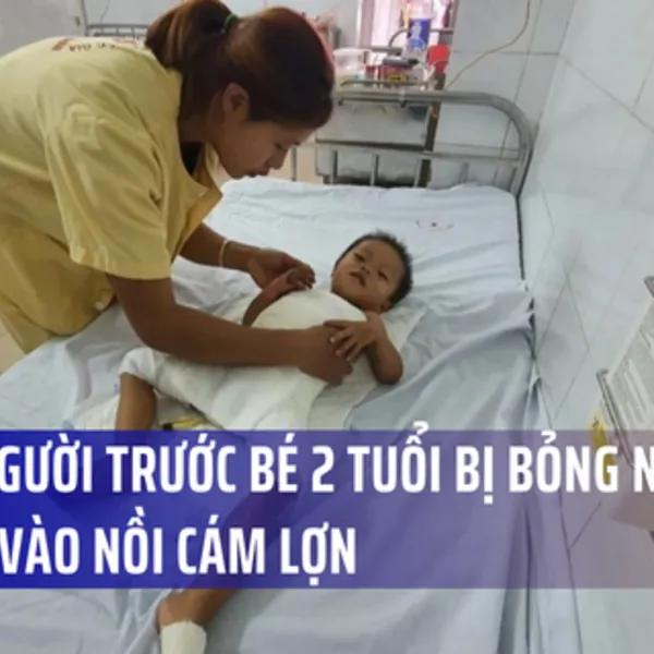 Lặng người trước bé 2 tuổi bị bỏng nặng vì ngã vào nồi cám lợn