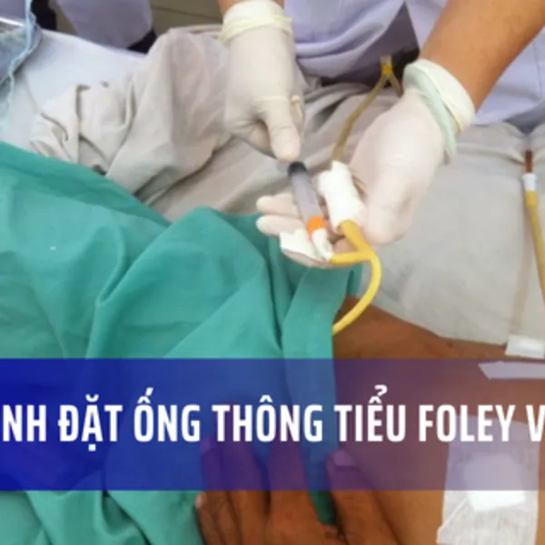 Hướng dẫn cách đặt ống thông tiểu foley: Quy trình và lưu ý