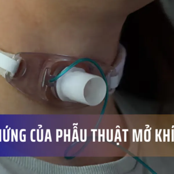 Các biến chứng và rủi ro của phẫu thuật mở khí quản