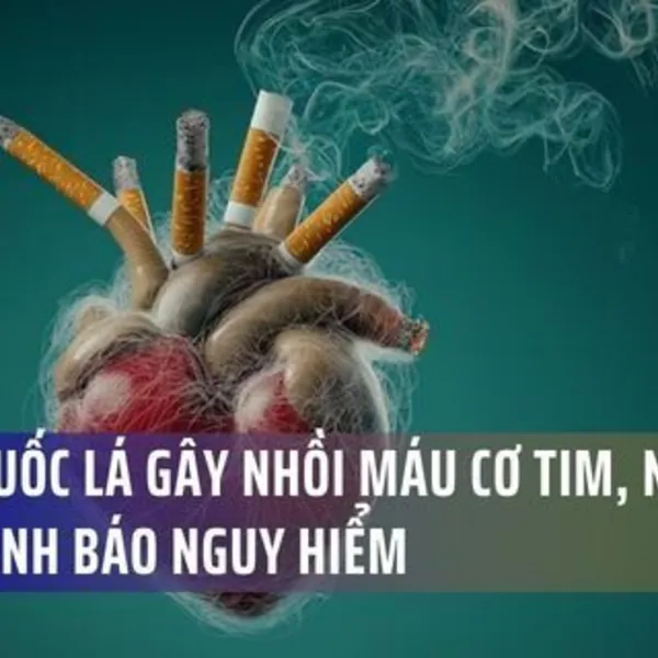 Hút Thuốc Lá Gây Nhồi Máu Cơ Tim, Ngừng Tim: Cảnh Báo Nguy Hiểm