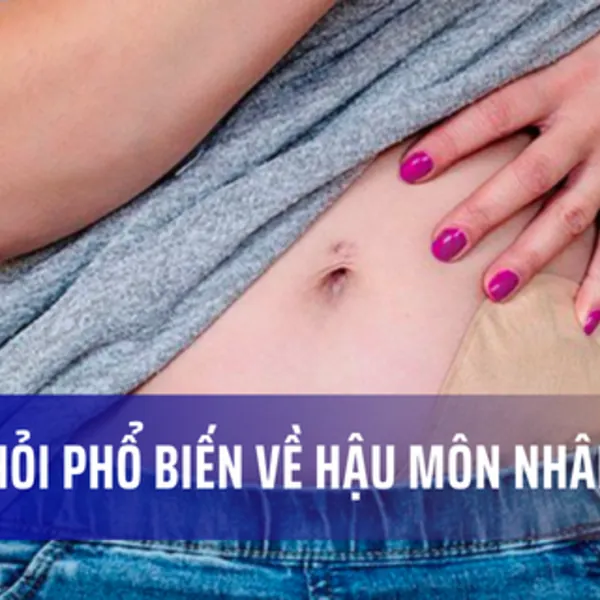 9 câu hỏi về việc sống chung với hậu môn nhân tạo (HMNT)