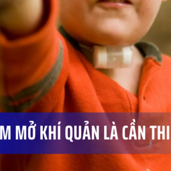Tầm quan trọng của làm ẩm mở khí quản