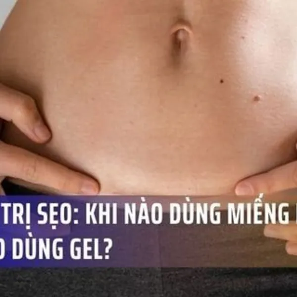 Bí mật trị sẹo của chuyên gia: Khi nào dùng miếng dán, khi nào dùng Gel?