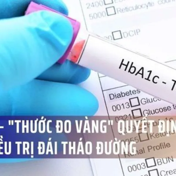 HbA1c – "Thước Đo Vàng" Quyết Định Hiệu Quả Điều Trị Đái Tháo Đường