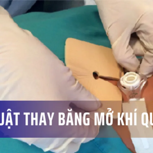 Kỹ thuật thay băng mở khí quản