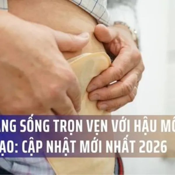 Cẩm Nang Sống Trọn Vẹn Với Hậu Môn Nhân Tạo: Cập Nhật Mới Nhất 2026