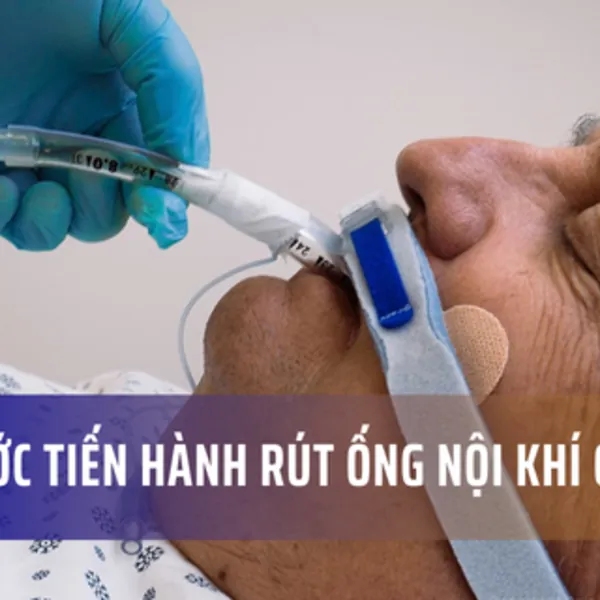 Các bước tiến hành rút ống nội khí quản